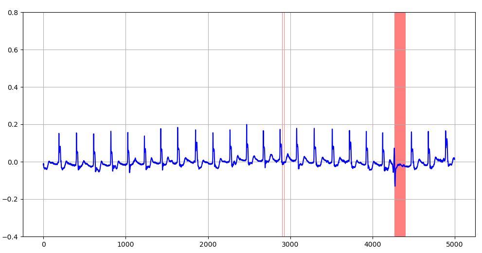学習データのMAE上限閾値を超える異常値を示す評価データ波形（赤塗りの部分：訓練データ数10,000）