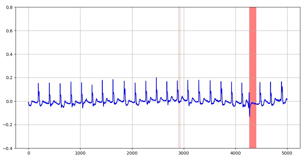 学習データのMAE上限閾値を超える異常値を示す評価データ波形（赤塗りの部分：訓練データ数20,000）